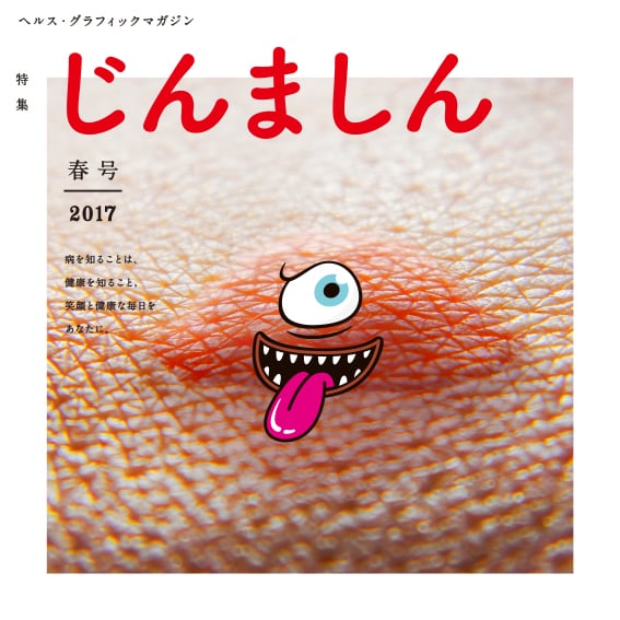 2017年4月発行の最新号は「じんましん」特集! お子さんの蕁麻疹にお悩みのご家庭はぜひご一読を。